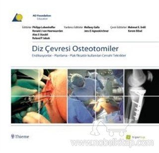 Diz Çevresi Osteotomiler & Endikasyonlar - Planlama - Plas Fiksatör Kullanılan Cerrahi Teknikler