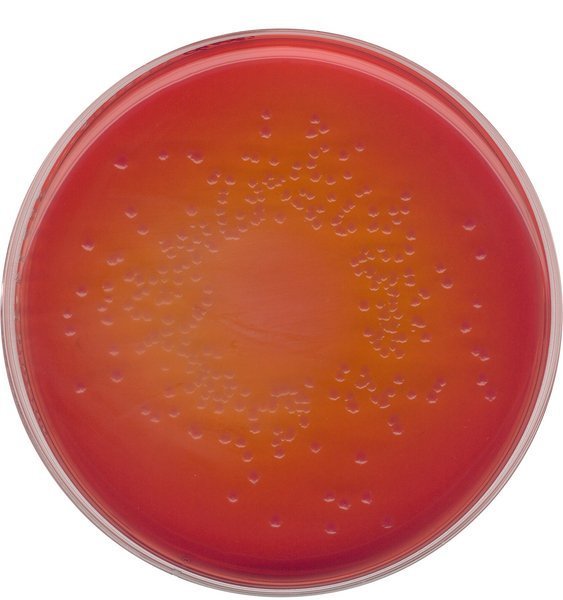 Merck 105465 Macconkey Agar For The İsolation Of Salmonella, Shigella And Coliform Bacteria (According Harm. Ep/Usp/Jp) 500 gr