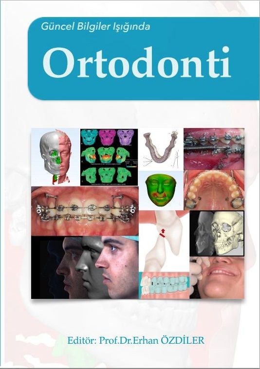 guncel bilgiler isiginda ortodonti